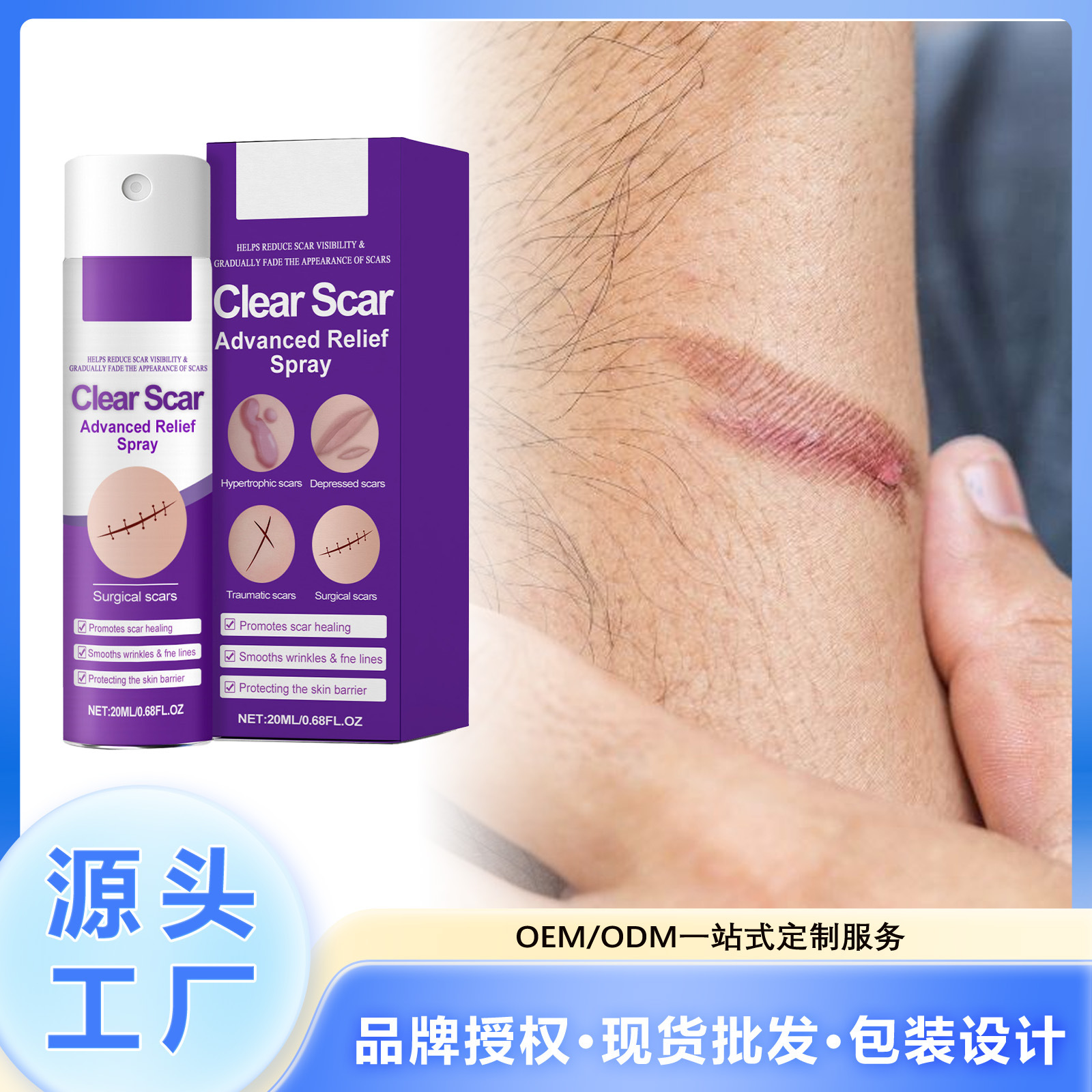 Skin Care Spray, Gentle Formula, Moisturizes, Smoothes and Cares for Delicate Skin, Comfortable Care, External Application Spray