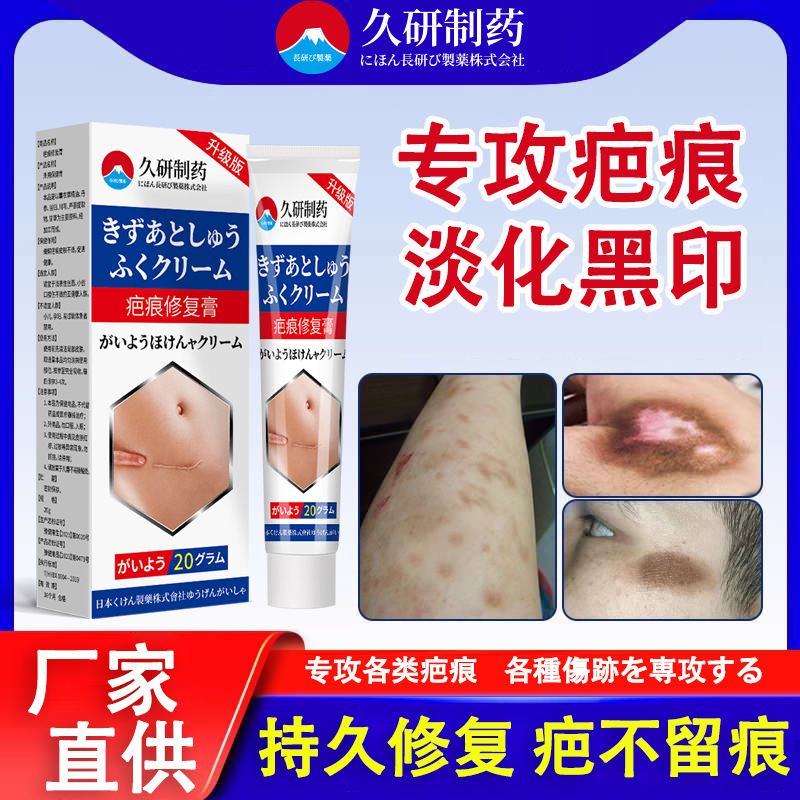 長期間研究開発された薬用傷跡クリームは、傷跡を軽く修復し、腫れを除去し、ニキビを除去し、メラニン沈着を除去し、黒い跡を軽減します。|undefined
