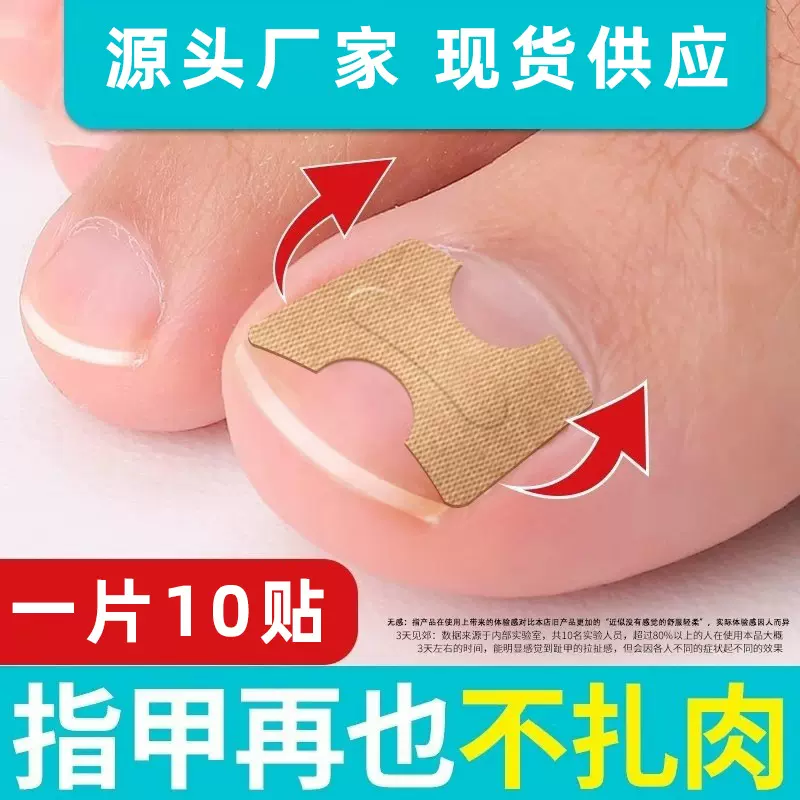 免胶水正甲贴脚趾甲贴片拉拉贴指甲贴指甲修护甲沟矫正贴厂家现货