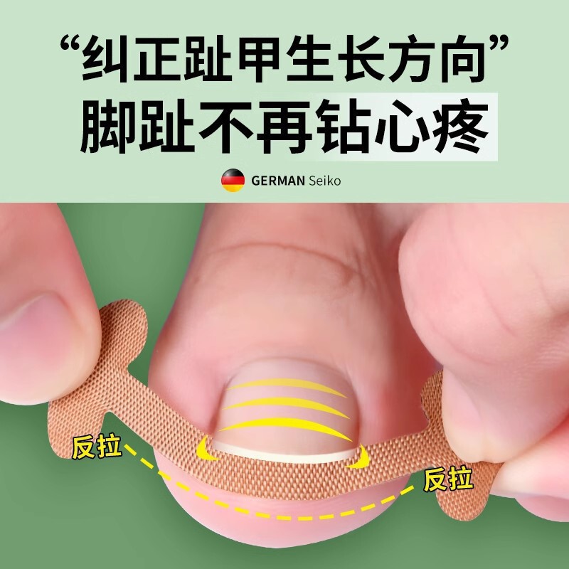 New Glue-Free Nail Patch for Toenails, Nail Groove Ingrown Toenail Orthosis, Toenail Patch for Manicure