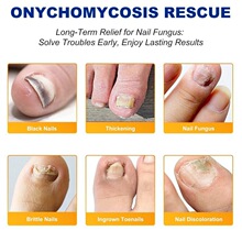 ���R�dˮ���z��ָ���N�_ֺ���o��ܛ��Ƕ������ל�ָ���NƬ