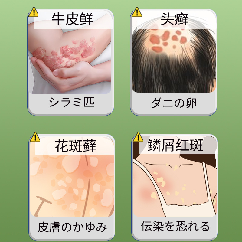 牛皮藓保健液皮肤不适瘙痒小包外用保健液喷剂护理液牛皮藓喷雾|undefined