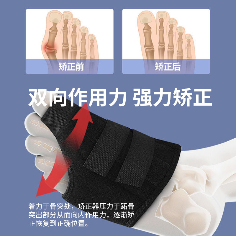 親指の外転矯正器は大きい母の足の指の足のアルミニウムの条項を分けて改善します。|undefined