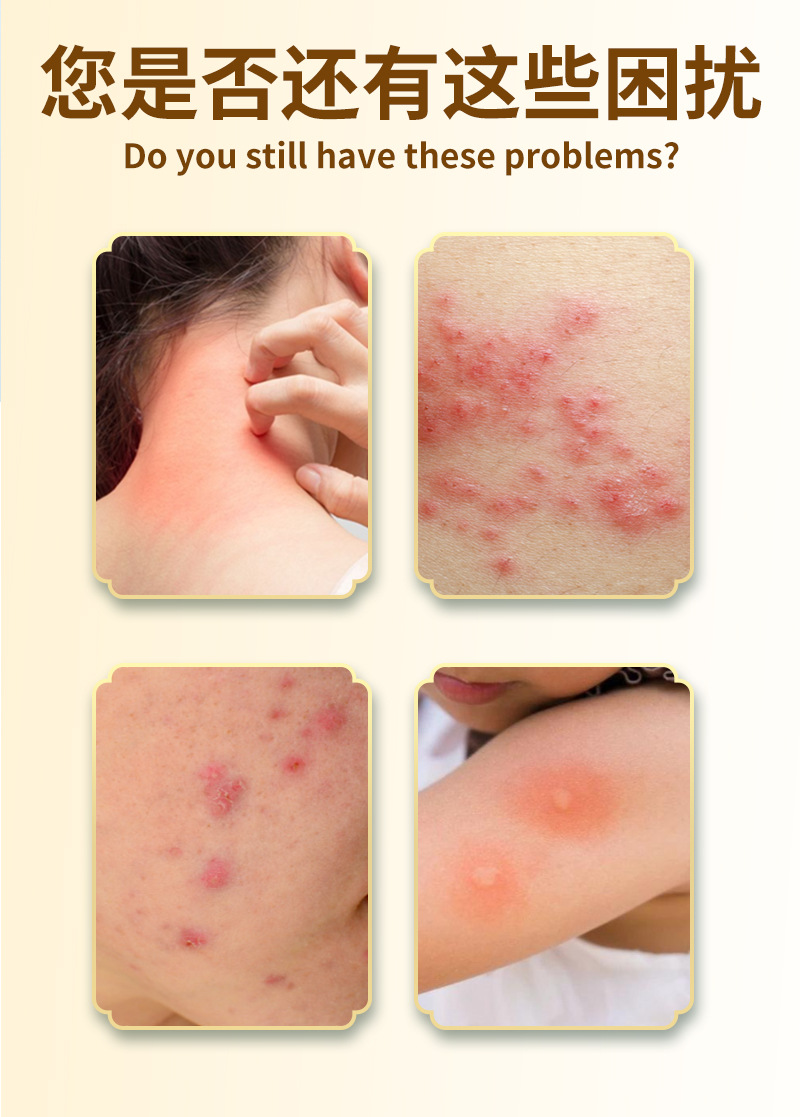 Yao Benren Skin External Discomfort Ointment Cream for Itchy Red Swollen Skin 20g quality and texture