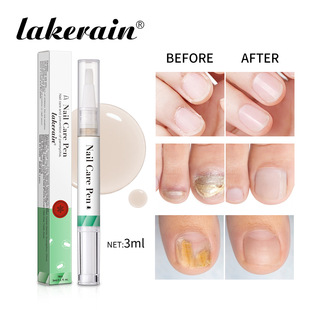 Lakerainָ�����׹P ����Nail Growth Oil