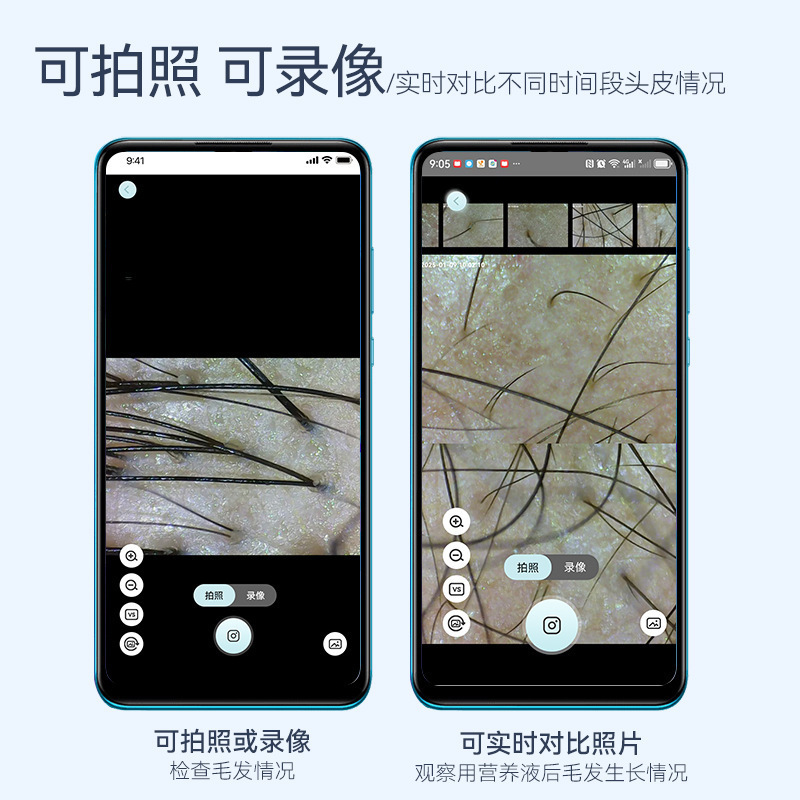 新款智能头皮WiFi高清检测仪毛囊皮肤分析仪 家用便携式养发馆|undefined