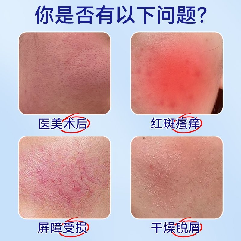 妥能医用重组Ⅲ型人源化胶原蛋白修护液喷雾型修护肌肤屏障泛红|undefined