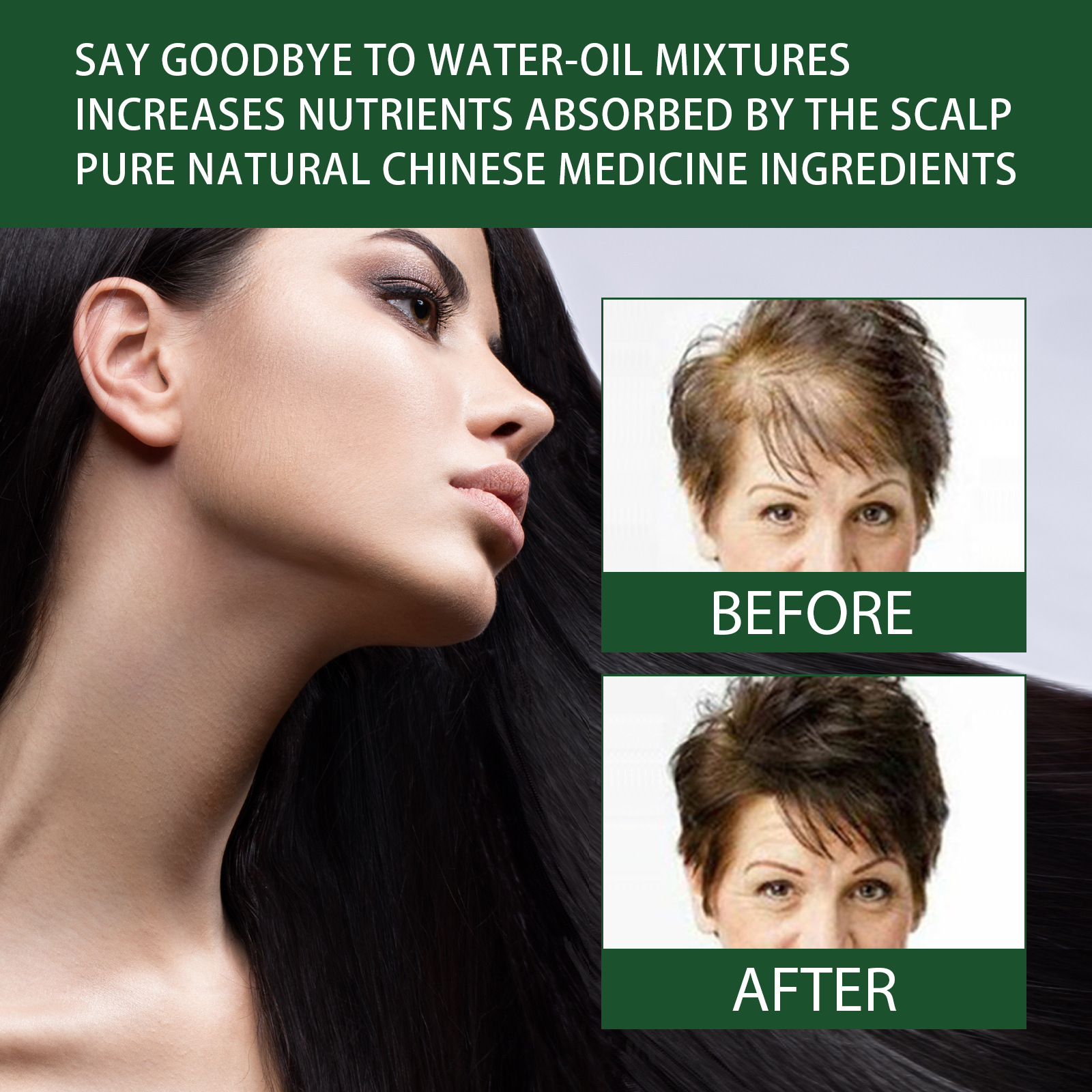 West&Month Growth essence Nourishing Care Essential Oil Dense Hair Ginger Nutrition_voghion.com