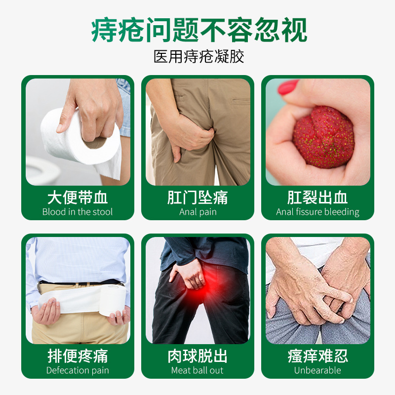 中国の薬用ハーブ医療痔ジェル内外痔核混合血便肛門裂傷痛み痔クリームロゴ付き|undefined
