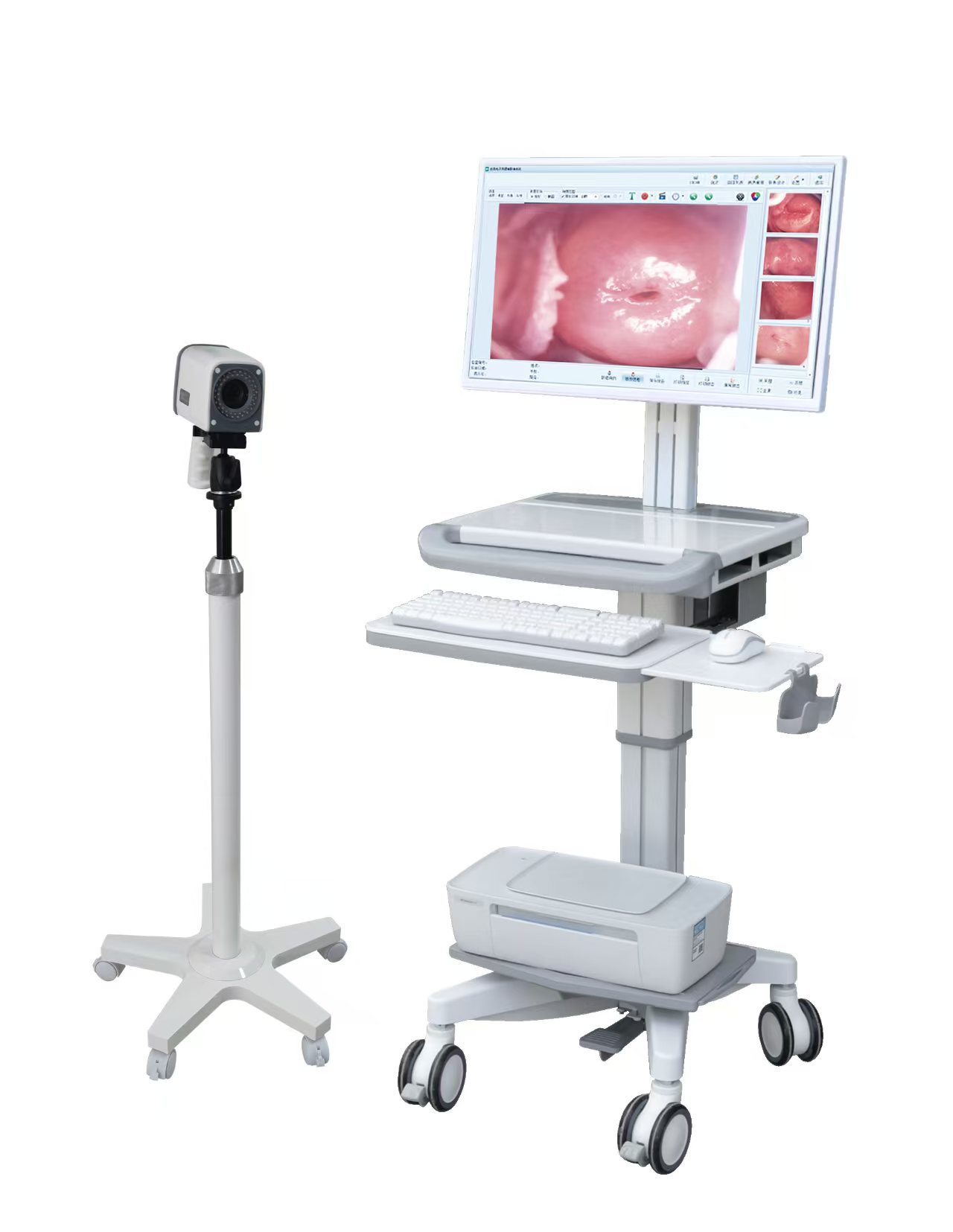 Medical Electronic Digital Colposcope for Gynecological Examination with Sony Imported Camera Head High-Definition Endoscope Direct from Manufacturer