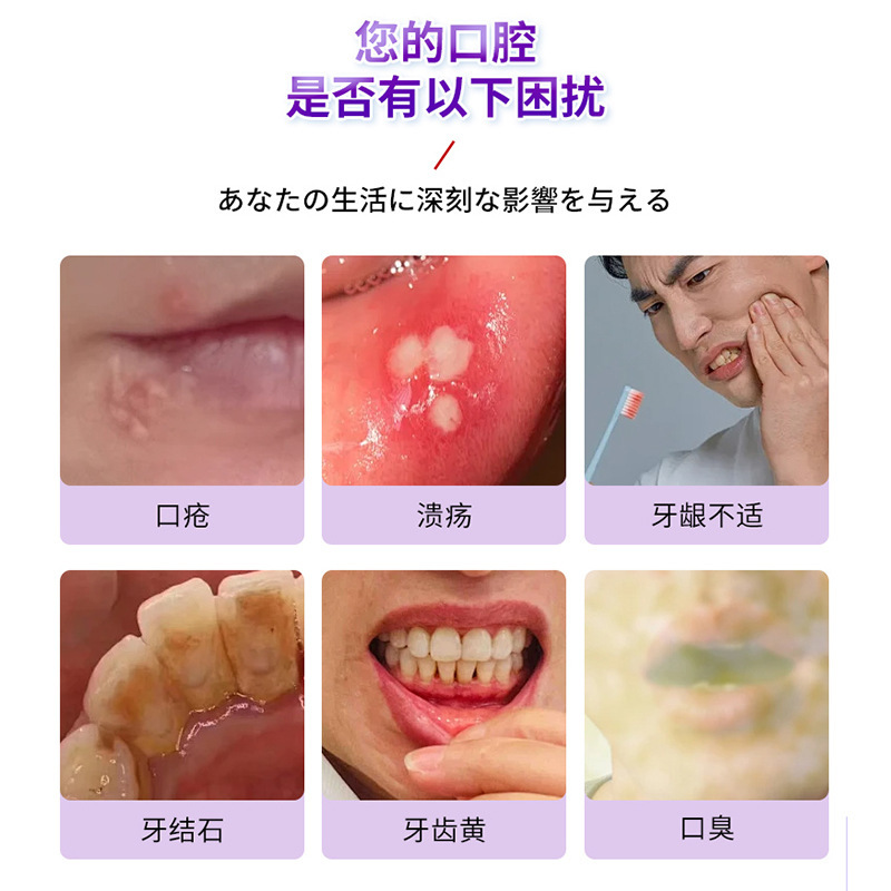 山本星奈口臭結石スプレー口臭不快口腔異臭歯石不快外用保健液|undefined