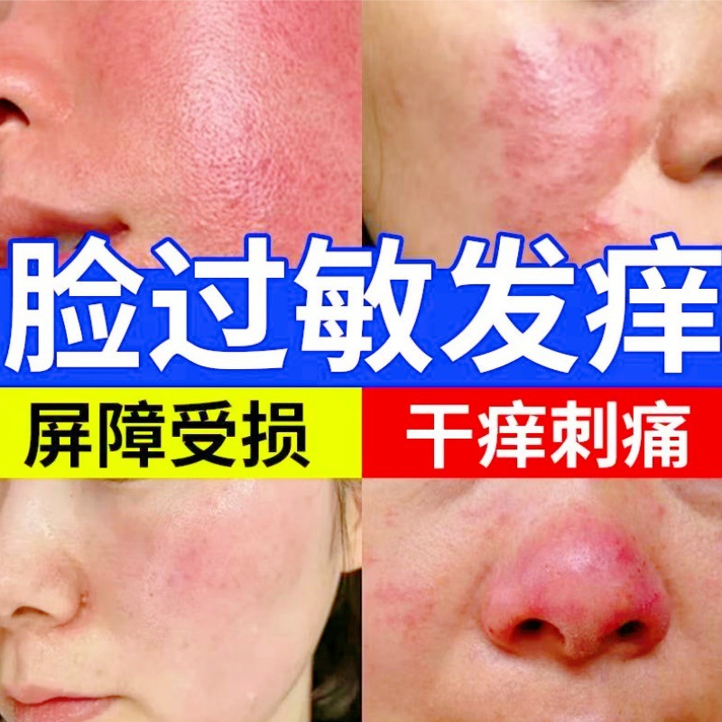 美容院祛斑后修复液大红脸红血丝补水止痒修护肌肤蜕皮后修护液