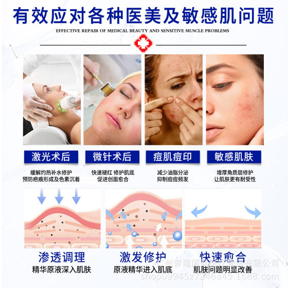The second type of mechanical size dressing medical beauty water light needle acne mark light red repair medical moisturizing spray moisturizing toner