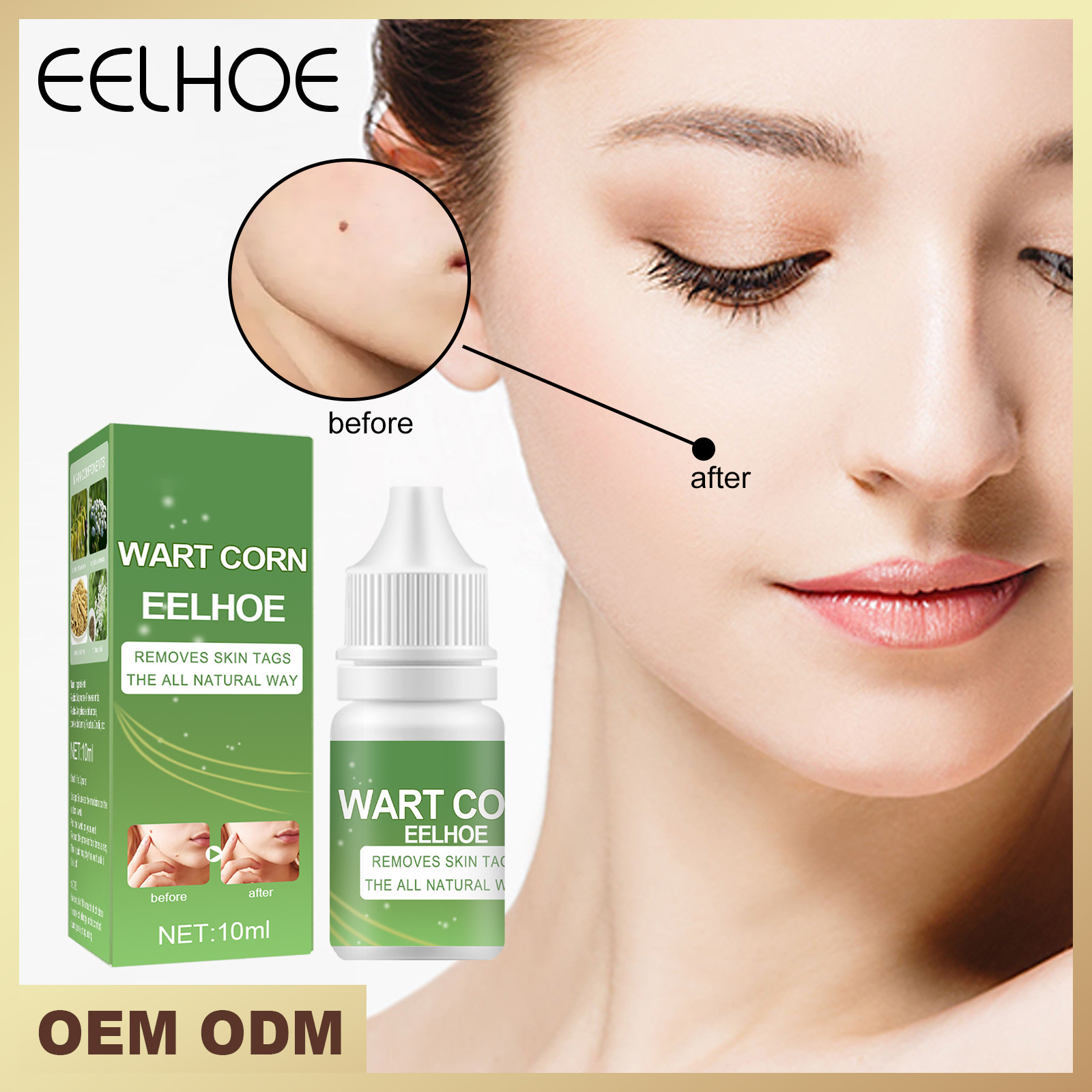 EELHOE nevus elixir for blemishes, removing black spots, lightening melanin, and repairing skin on the face_voghion.com