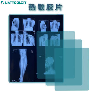 �����zƬ8*10CT��ʽ��ӡ����ʿ���PDR�²���ĤƬ�t��PET����