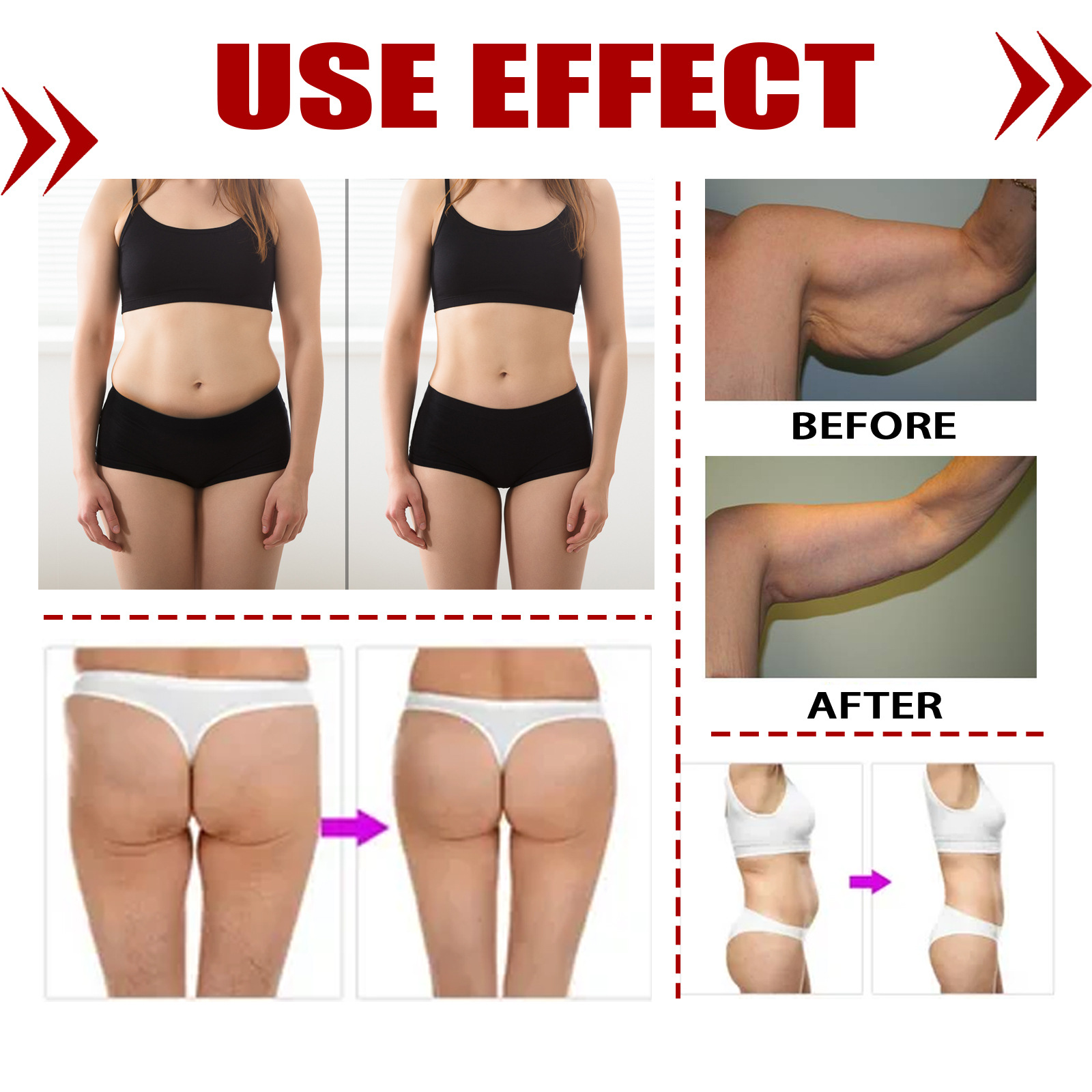 Jaysuing Shaping Stick für Achselhalsmassen, Entsalzung der Lymphe, Tongluo Xiaojie Fibroplasty_voghion.com
