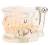 Teaching model removable oral repair model pathological dental model activity tooth model planting model