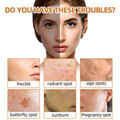 West&Month 薑黃洗臉皂 面部修護溫和清潔淡化斑點撫平細紋潔面皂