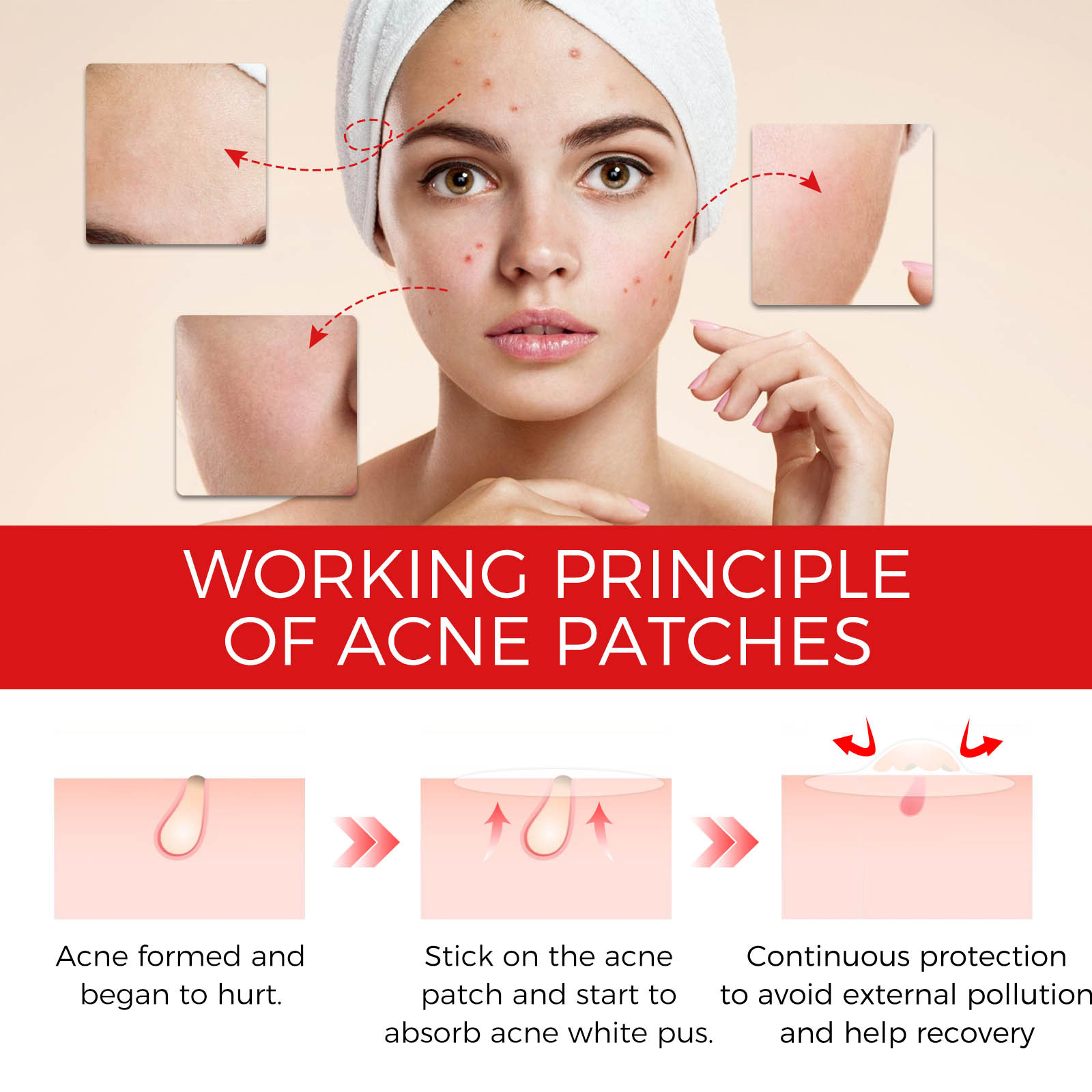 OUHOE Reparatie Gezichtsbedekking Verzachtende Huidverzorging Acne Patch_voghion.com