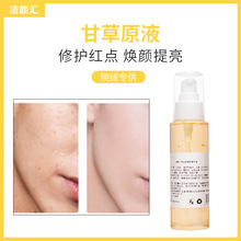 面部护理修护肌肤屏障甘草原液祛痘印淡化痘坑舒缓泛红保湿精华液