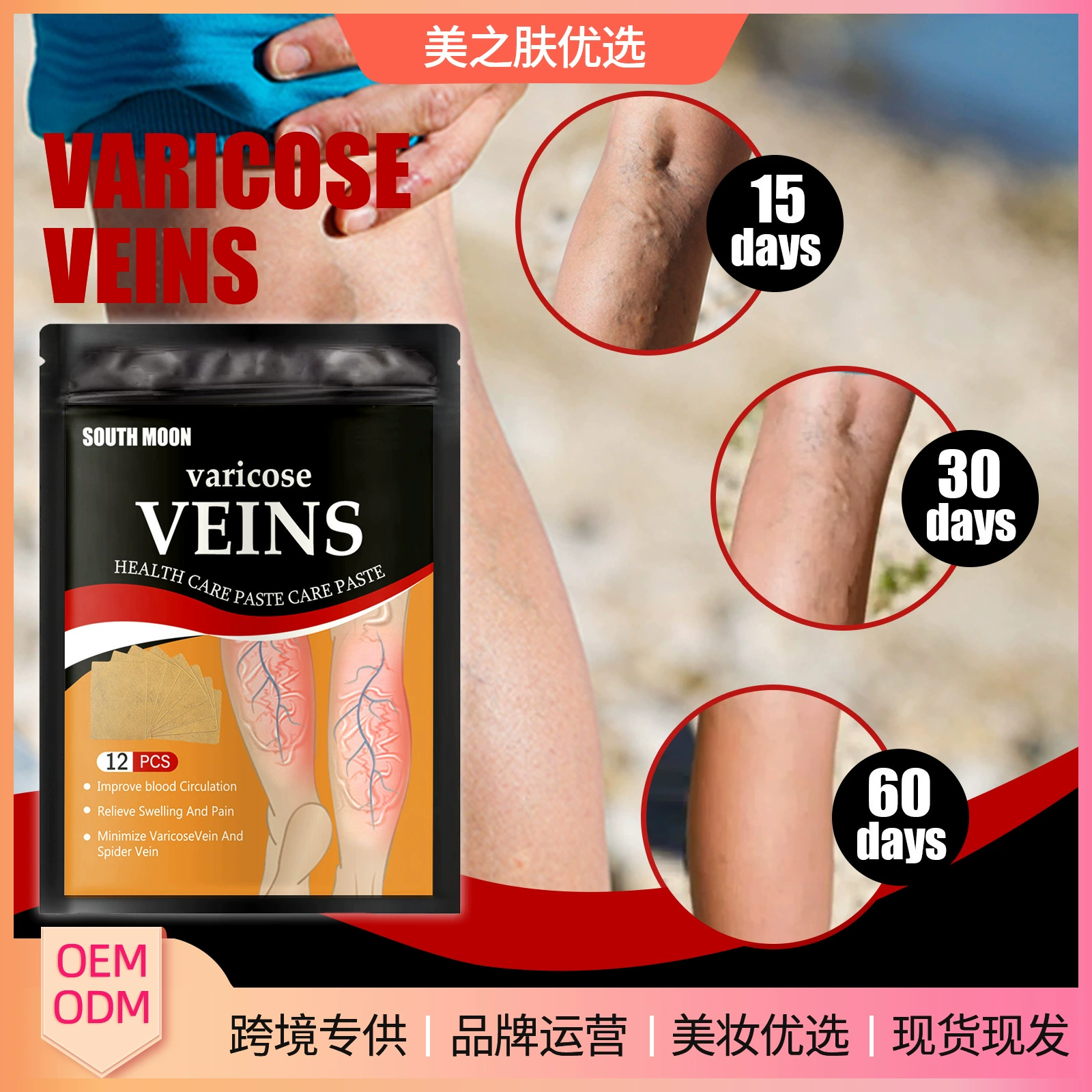 Венозный пластырь здоровья Южной Луны для снятия блокировки изогнутых кровеносных сосудов ног Холодный компресс Венозный пластырь здоровья