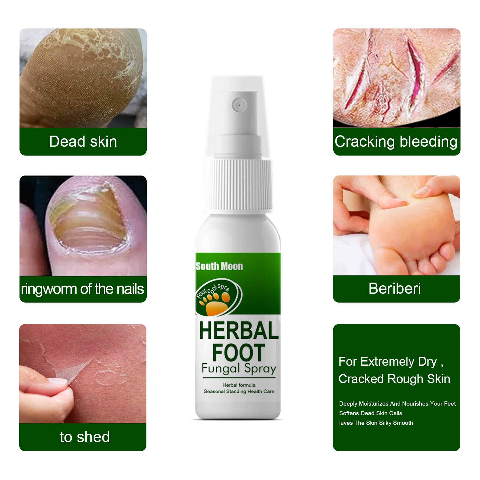 Herbal spray Sweat, Odor and Itch Relieving Foot Care Spray_voghion.com