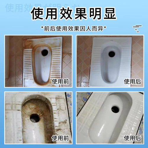 Urine alkali dissolving agent, toilet cleaner, urine test, urine scale cleaning agent, powerful yellowing and dirt removal toilet cleaning agent, blending agent