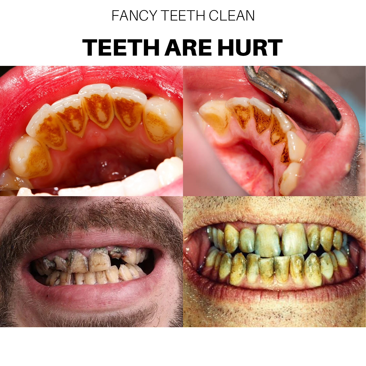 2023 New Tooth cleaning Mousse Fruity tooth Mousse Fresh breath to remove bad breath to remove tooth dirt stains_voghion.com