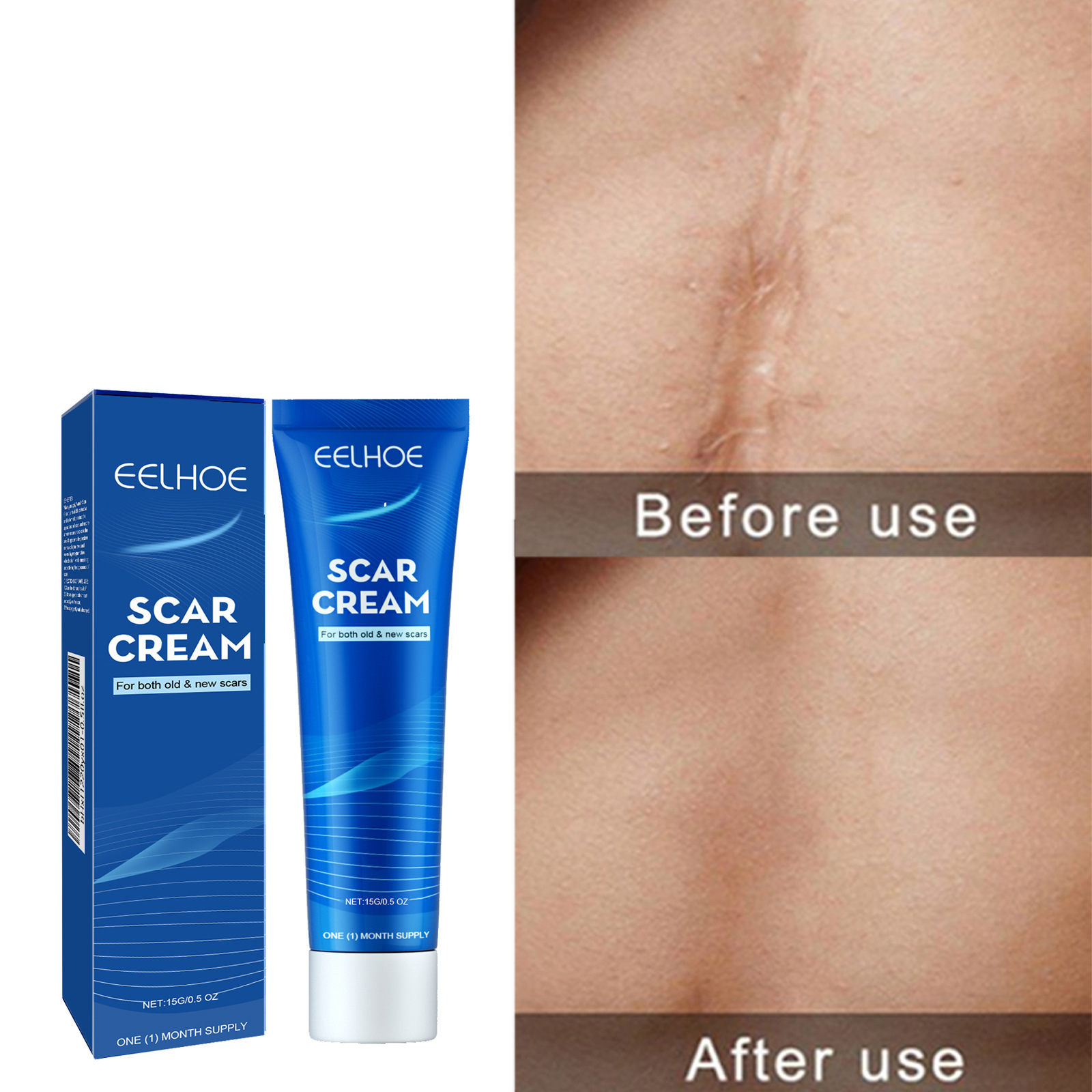 EELHOE Medical soft ointment