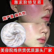ǿ���������˶����滺��˪���м��������޻�˪ȥ��Ѫ˿���ʲ�����