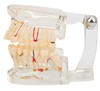 Teaching model removable oral repair model pathological dental model activity tooth model planting model