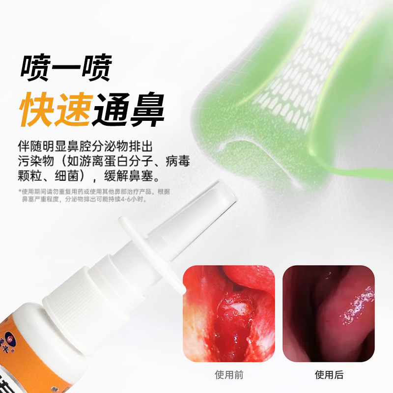 嬶专家抑菌喷剂鼻窦焱鼻腔不适通鼻塞流鼻水草本干鼻痒濞舒适喷雾|undefined