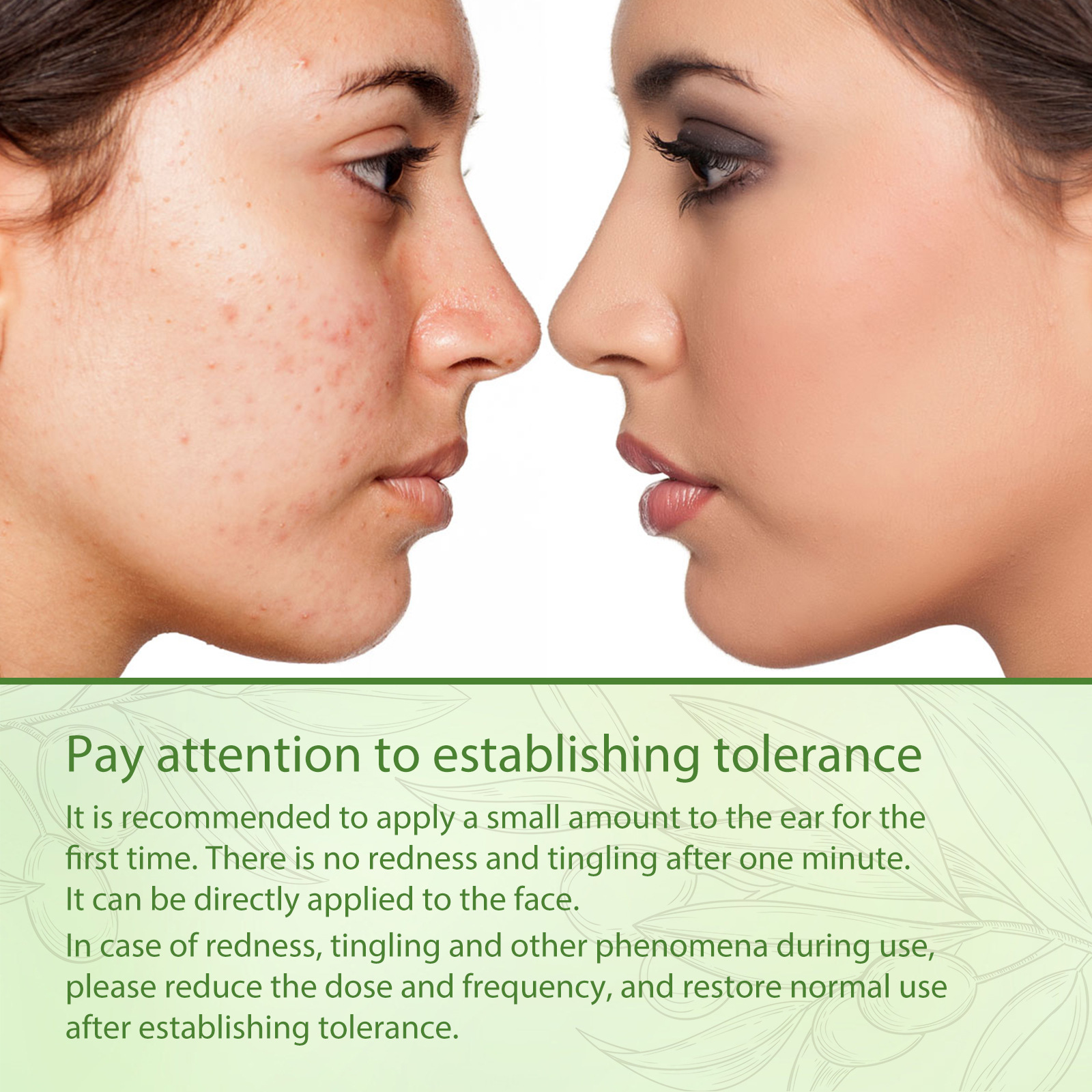 Esence s olivovým olejem West&Month pro odstranění akné se zavřenými ústy, zesvětlení skvrn po akné a opravu tmavé pleti_voghion.com