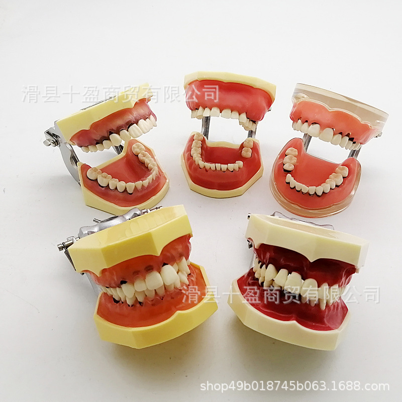 Dental Oral Teaching Model Periodontal Scaling Model Doctor-Patient Communication Periodontal Classification Practice Scaling Teaching