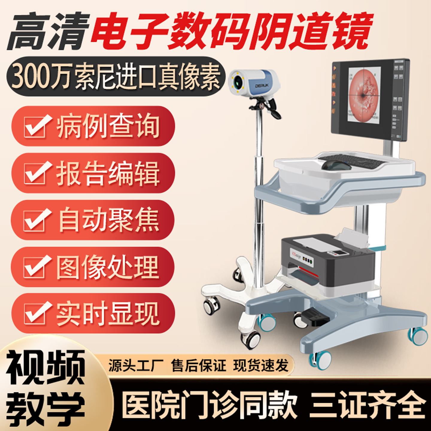 Colposcopio médico de alta definición endoscopio cervical vaginal colposcopio electrónico digital instrumento ginecológico de píxeles de alta definición