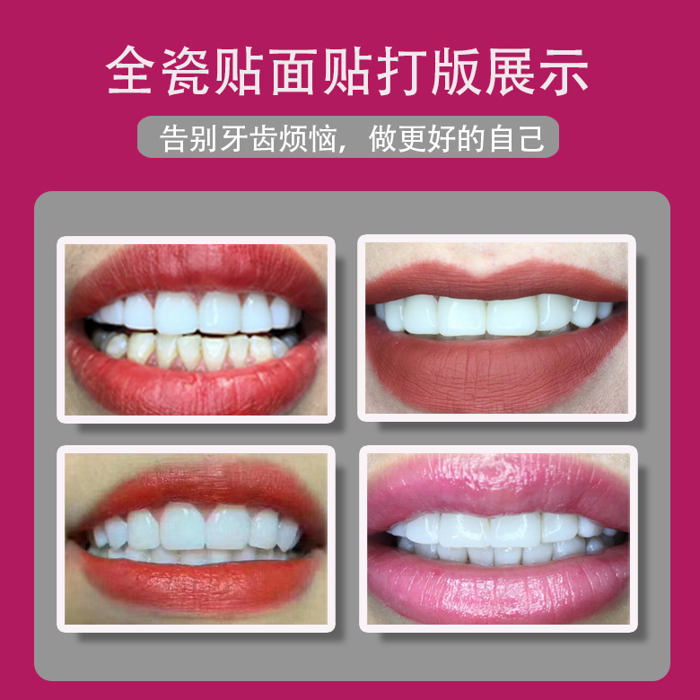 Dientes de belleza dental instrucción de referencia video Tutorial de belleza dental porcelana de resina de porcelana de hielo 6d nano relieve de silicio