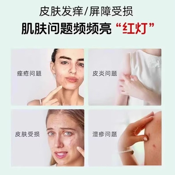 Sinopharm 漢方薬医療スキンケア軟膏在庫ありドロップシッピング公式正規価格優れた工場直送|undefined