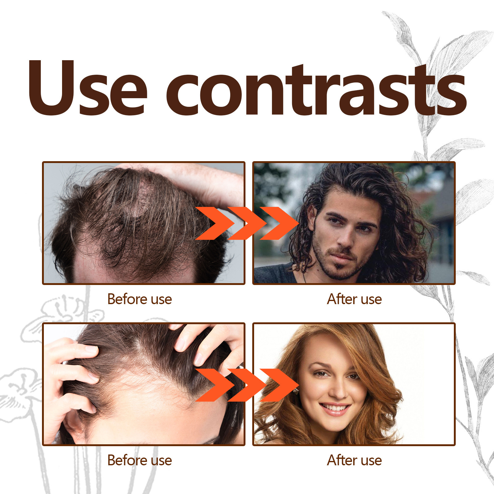 Esența de îngroșare a părului EELHOE întărește rădăcinile părului, hidratează scalpul, îngroașă părul, previne căderea părului și protejează esența părului._voghion.com