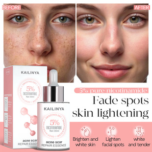 �羳���Q���R�d����aˮ���������沿���AҺ��ˬ�����۰׾��AҺ