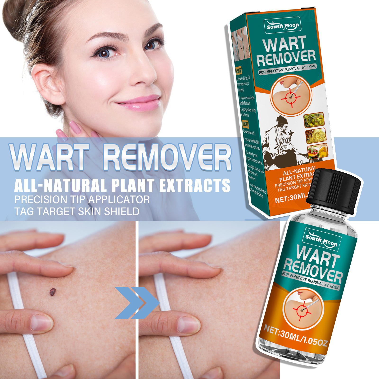 remover, skin removal, flat skin, especially calluses on hands feet, and chicken eye wart remover_voghion.com