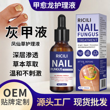 �P�ɻ��Ҽ�Һ������ָ�׻Ҽ׃��׻Ҽ�ܛ����ָ���o��Һ�F؛���l