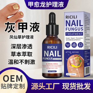 �P�ɻ��Ҽ�Һ������ָ�׻Ҽ׃��׻Ҽ�ܛ����ָ���o��Һ�F؛���l