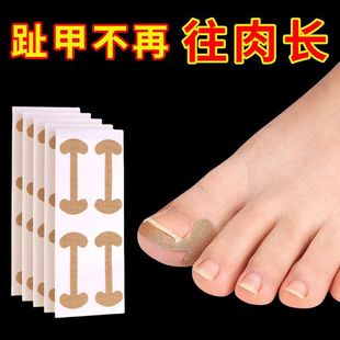 Glue-free nail sticking nail groove nail correction toe nail nail nail patch Lala manicure factory goods