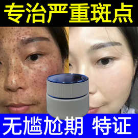 代加工祛斑液分解色素去斑液精华液  控色霜排色美容院面部祛斑霜