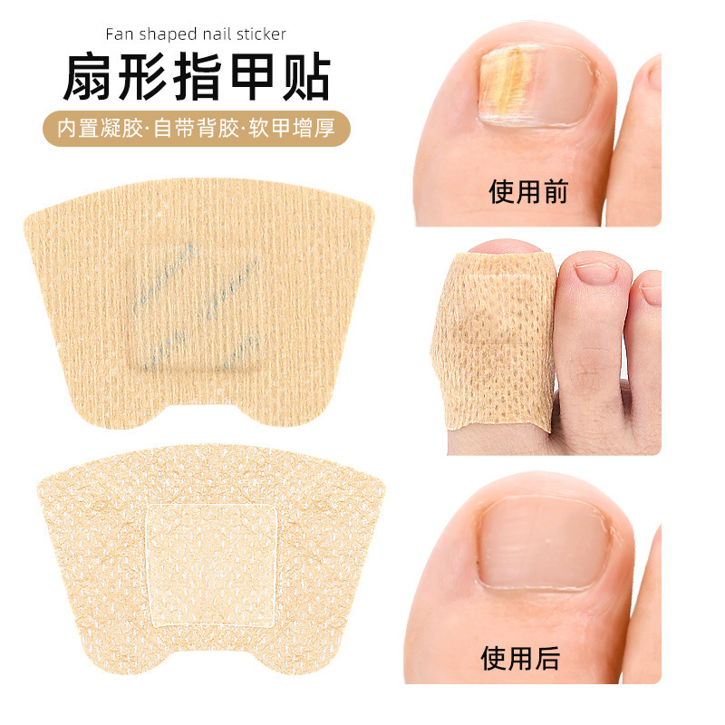 Fan-Shaped Hydrogel Onychomycosis Repair Patch Soft Ingrown Toenail Thickening Toenail Care Nail Groove Nail Patch