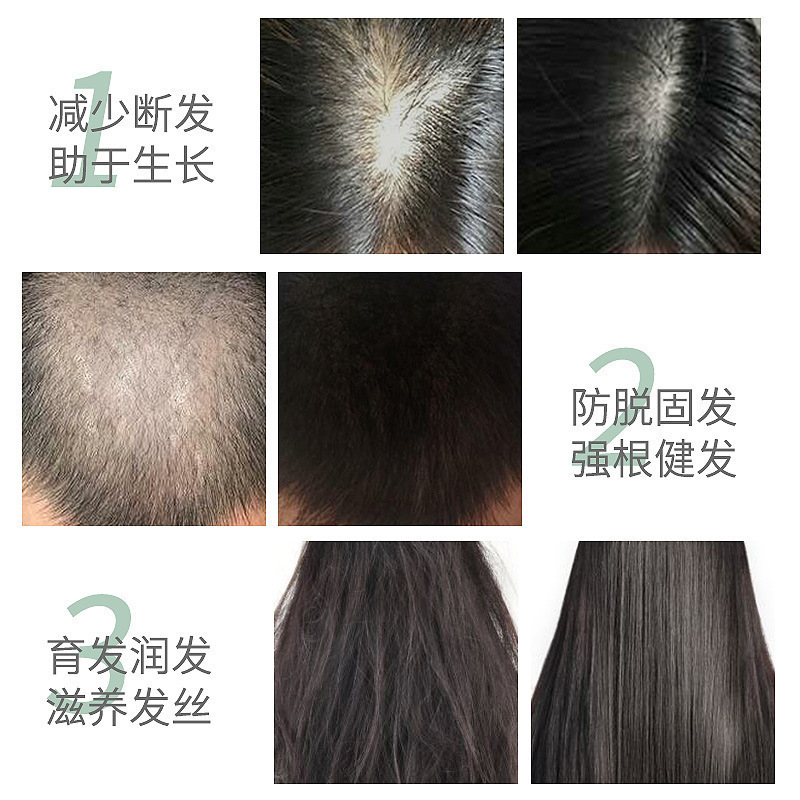 何首乌育发液生头发液头发猛长修复毛囊保湿发际线防脱固发剂精华|undefined