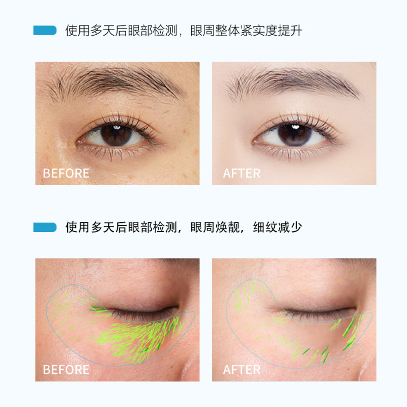 【送镊子】MKING PRETTY晶润紧致抗皱眼膜补水保湿盈润焕靓眼周女|undefined