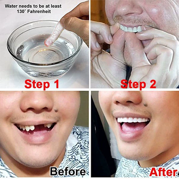 Кросс-брендовая электронная торговля Instant Smile отбеливание силиконовые брекеты моются и повторно используются имитированные зубы