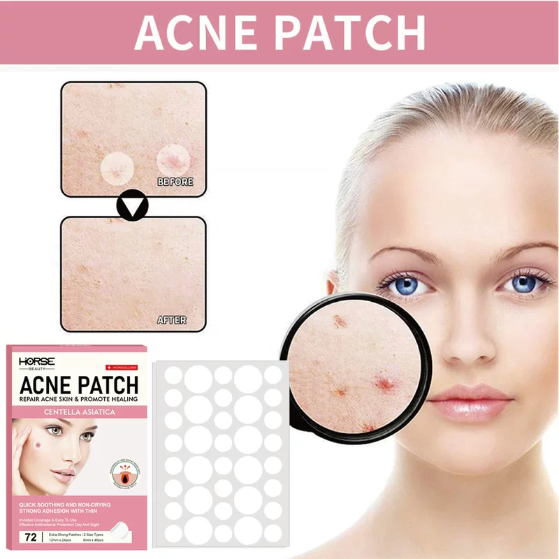 (Cross-border trading), invisible revitalizing acne patch, foundation, conceals acne