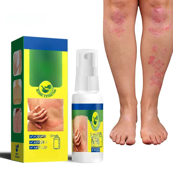 Eraycee Cross-Border Plant Extract Skin Fresh Care Solution Antibacterial Spray Skin External Itching 30ml
